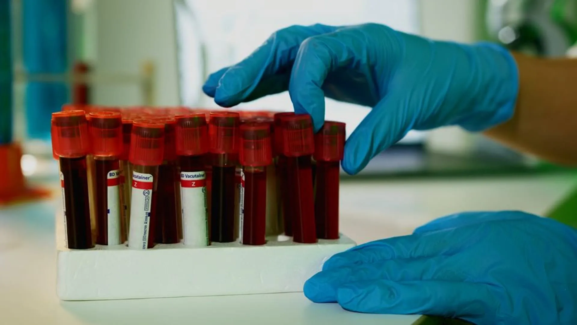 Rows of colour-coded pathology blood collection tubes in a laboratory